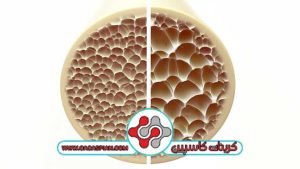 کمبود کلسیم